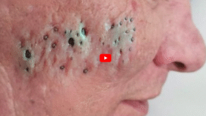 Natural Skin Brightening: Safe & Effective Ways to Achieve a Healthy, Even Glow  Many people searc