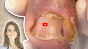 How to Remove Nail Glue From Skin Safely: A Complete Guide