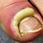 Natural Herbal Ways to Make Small Nails Grow Faster and Stronger