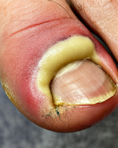 Natural Herbal Ways to Make Small Nails Grow Faster and Stronger