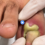 Nail Care Tips and Healthy Eating for Strong Nails