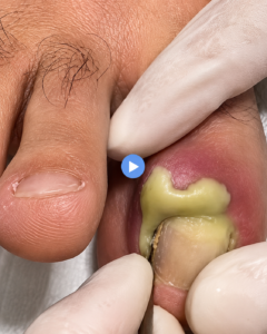 Nail Care Tips and Healthy Eating for Strong Nails