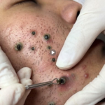 Skin Tightening Tips: Natural Ways to Keep Your Skin Firm and Youthful