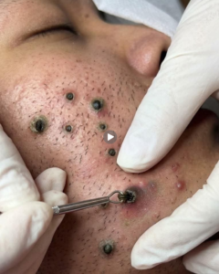 Skin Tightening Tips: Natural Ways to Keep Your Skin Firm and Youthful