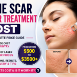 Acne Scar Laser Treatment Cost: Complete Price Guide, Factors & Results (2026)