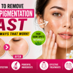 How to Remove Hyperpigmentation Fast: Causes, Treatments & Skincare Guide