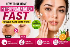 How to Remove Hyperpigmentation Fast: Causes, Treatments & Skincare Guide
