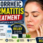 Seborrheic Dermatitis Treatment: Best Medical & Natural Remedies for Lasting Relief