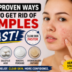 8 Proven Ways to Get Rid of Pimples Fast Naturally and Safely