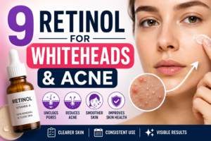 9 Best Retinol and Retinoid Options for Whiteheads & Acne