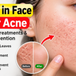 Holes in Face After Acne: Causes, Treatments & Prevention