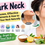 Dark Neck: 7 Causes, Treatments & How to Lighten Your Neck Naturally