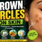 Brown Circles on Skin: Causes, Treatment & Prevention Guide (2026)