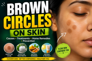 Brown Circles on Skin: Causes, Treatment & Prevention Guide (2026)