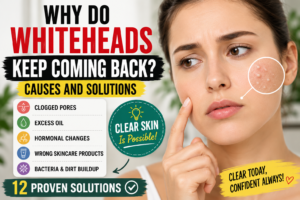 Why Do Whiteheads Keep Coming Back? Causes, Prevention & Best Solutions