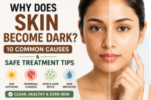 Why Does Skin Become Dark? 10 Causes & Safe Treatment Tips