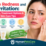 Face Redness and Irritation: Causes, Treatment & Skin Care Tips