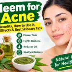 Neem for Acne: Benefits, How to Use It, Side Effects & Best Skincare Tips