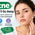 Acne That Won’t Go Away: Causes, Treatment & When to See a Dermatologist