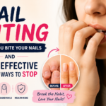Nail Biting: Why You Bite Your Nails and 10 Ways to Stop