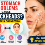 Can Stomach Problems Cause Blackheads? Gut-Skin Connection Explained