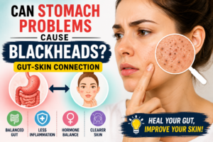 Can Stomach Problems Cause Blackheads? Gut-Skin Connection Explained