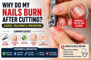 Why Do My Nails Burn After Cutting? Causes, Treatment & Prevention