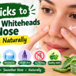 7 Tricks to Remove Whiteheads on Nose at Home Naturally