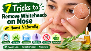 7 Tricks to Remove Whiteheads on Nose at Home Naturally