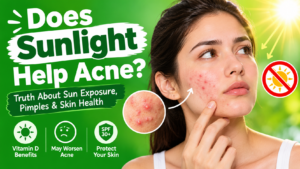Does Sunlight Help Acne? Effects of Sun on Pimples