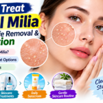 How to Treat Facial Milia: Causes, Safe Removal & Prevention
