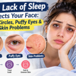 How Lack of Sleep Affects Your Face: Dark Circles & Puffy Eyes